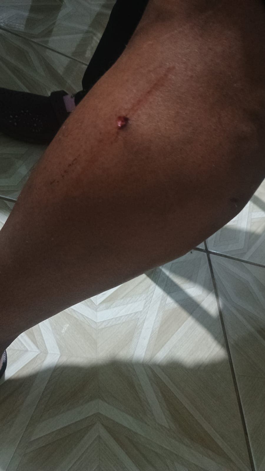 Mulher é atacada por cães próximo à passarela em Carandaí
